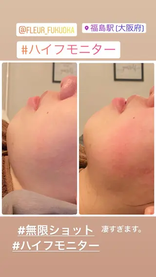 FLEUR大阪・整体 ・ハイフ・痩身・小顔のエステ・リラクイメージ