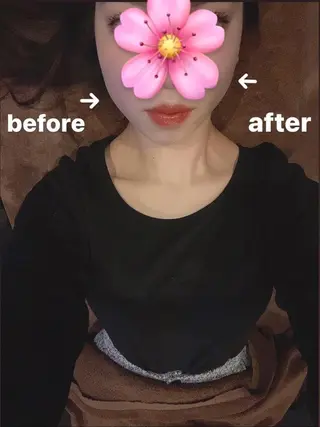 美容鍼灸サロン LOMIHARIのエステ・リラクイメージ