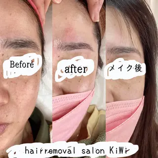 アイブロウ 脱毛サロン KiWiのエステ・リラクイメージ