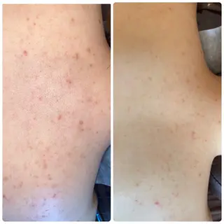 FLEUR大阪・整体 ・ハイフ・痩身・小顔のエステ・リラクイメージ