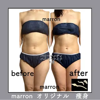 marron所属・痩身ハイパーナイフ ララピールリアボーテのエステ・リラクイメージ