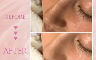 韓国肌管理専門店 Clear Lab 池袋所属・韓国肌管理専門店 池袋店REIKAのエステ・リラクイメージ