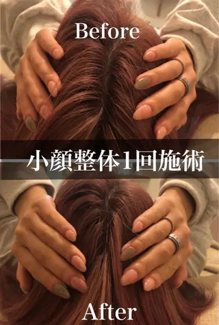 鍼灸整骨院Refine所属・鍼灸 Refineのその他イメージ