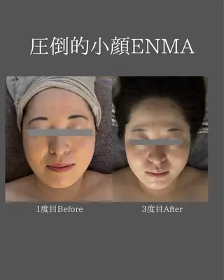 BLOSSOM 菊地のエステ・リラクイメージ