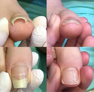 サンキューフット浦和店所属・サンキューフット 浦和店のエステ・リラクイメージ