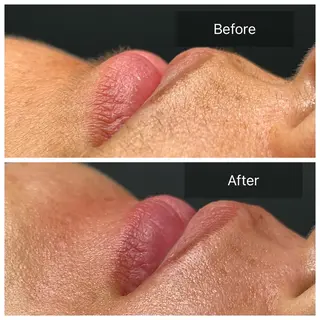 Salon Improveのネイルデザイン