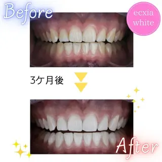 セルフホワイトニング エクシア五反田店のその他イメージ