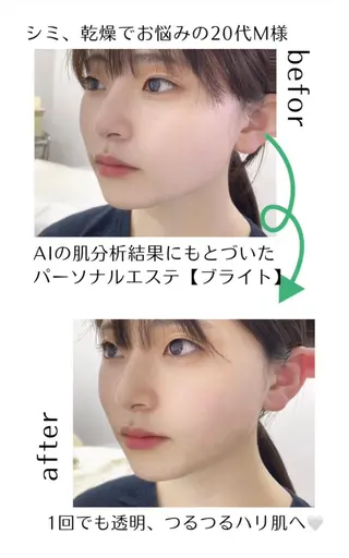 ポーラ美・Bloom所属・ポーラ 美・Bloomのエステ・リラクイメージ