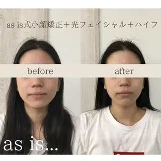 小顔専門アズイズ ビューティー　草津店のエステ・リラクイメージ