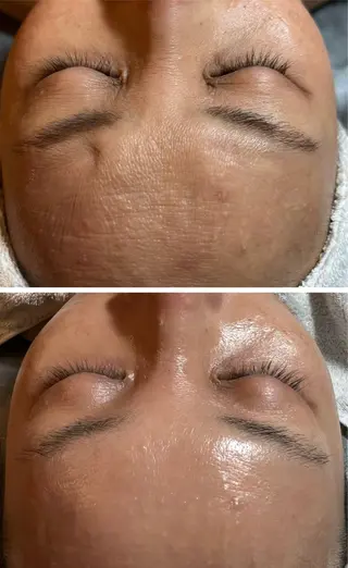 esty hitomiのエステ・リラクイメージ