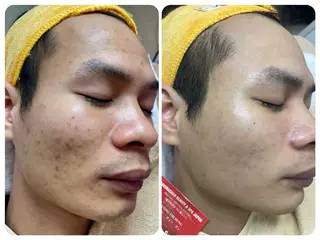 ニキビ、痩身、脱毛、 サクラチャンスパのエステ・リラクイメージ