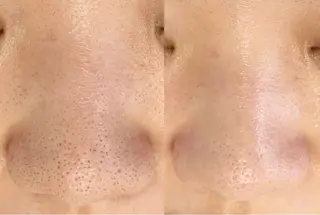 メンズ salonLADYSTYLE所属・稲嶺 美華のエステ・リラクイメージ