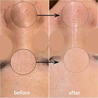 韓国肌管理 【毛穴専科】のエステ・リラクイメージ