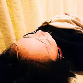 むくみたるみ専門☆ 美容鍼・小顔矯正のエステ・リラクイメージ