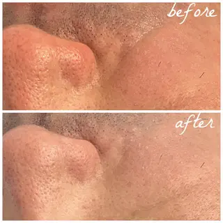 メンズ メナード岐阜茜部 杉浦のエステ・リラクイメージ