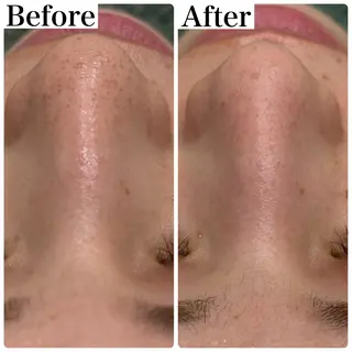 脱毛&フェイシャル 専門店muro.のエステ・リラクイメージ