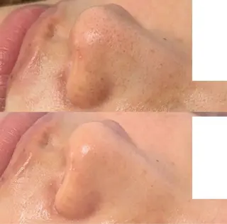 毛穴レス美肌へ🌿 看護師Abe🌼のエステ・リラクイメージ