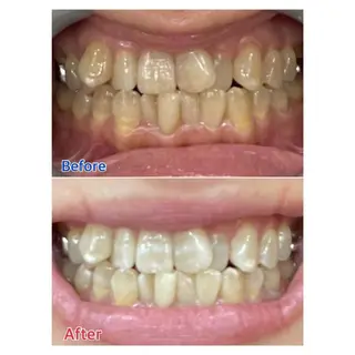 MBEAUTYSALON 千葉店・京成大久保所属・Melty 輝のその他イメージ