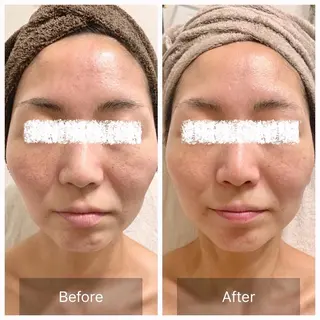 Charis エステ&ネイルのエステ・リラクイメージ