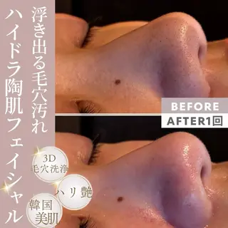 Beauty salon  Liko所属・LIKO フェイシャル&ボディのエステ・リラクイメージ