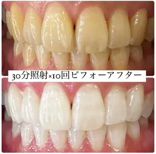 PLATINUM Beauty 横浜店所属・ホワイトニングルーム 横浜店のその他イメージ