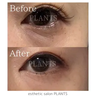 esthetic salon PLANTS所属・エステティックサロン PLANTSのエステ・リラクイメージ