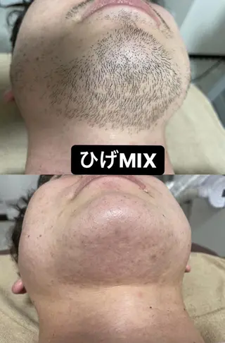 キッズ メンズ Epina 千葉店 【エピナ】のエステ・リラクイメージ