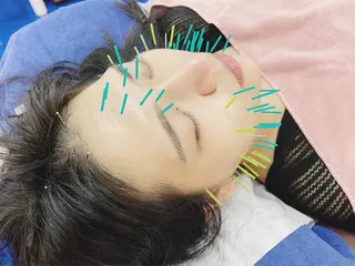 小顔美容鍼専門サロン 渋谷YZのエステ・リラクイメージ