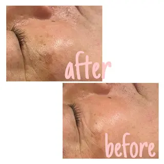 アルカンジュ~archange~所属・痩身/毛穴洗浄/脱毛 アルカンジュのエステ・リラクイメージ