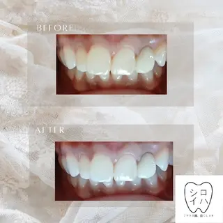 ホワイトニングサロン シロイハ所属・歯を白くしたい方🦷 シロイハのその他イメージ
