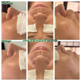 ぱんだ王国エステ所属・ぱんだ王国 エステのエステ・リラクイメージ