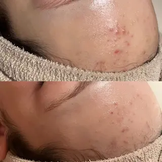 for woman所属・森 美優のエステ・リラクイメージ