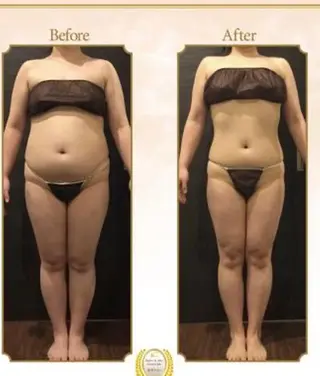 所沢痩身小顔コルギ AromaQueenのエステ・リラクイメージ