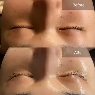 Mandarin Orange所属・毛穴から始める肌メン テマンダリンオレンジのエステ・リラクイメージ