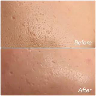 L’Beige レベージュのエステ・リラクイメージ