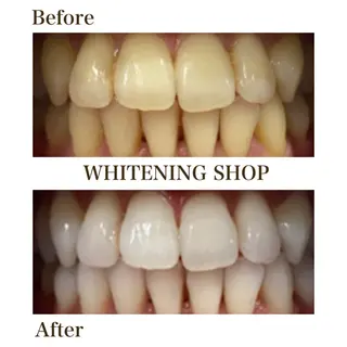 メンズ キッズ ホワイトニング ショップ川越店のエステ・リラクイメージ