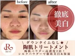 WHITE AQUA岐阜所属・WHITEAQUA 岐阜のエステ・リラクイメージ