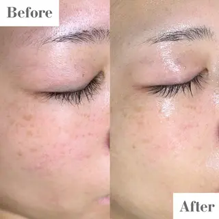 uni. RYOKAのエステ・リラクイメージ