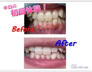 セルフホワイトニングサロン　ラヴィアン所属・ホワイトニングサロン La vie enのその他イメージ