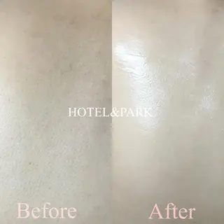 HOTEL&PARK . ワックス脱毛のエステ・リラクイメージ