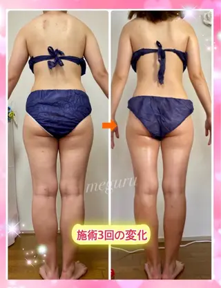 ショート カラー パーマ ヘアアレンジ メンズ キッズ ネイル マツエク・マツパ ‍痩身＆ボディ 結果出し🌟丹野のエステ・リラクイメージ