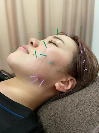 小林整骨院玉川 キジマのエステ・リラクイメージ