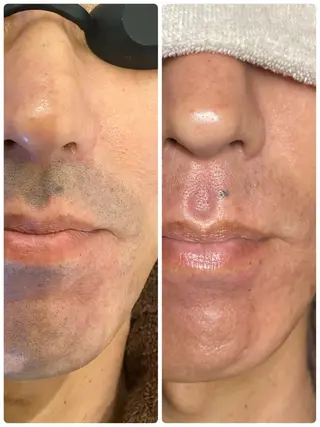 メンズ メンズガーデン今池店所属・メンズガーデン 今池の眉毛・アイブロウイメージ