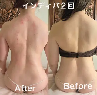 【ハイパーナイフ痩身&小顔コルギ&ハーブピーリング】K-Beauty　東新宿所属・kーbeauty痩身 フェイシャルのエステ・リラクイメージ