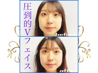 小顔美容鍼専門サロン 渋谷YZのエステ・リラクイメージ