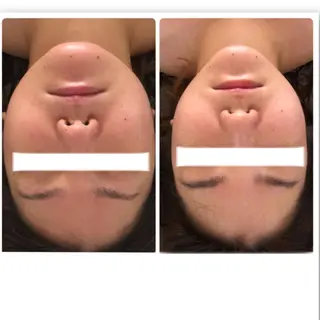 FLEUR大阪・美容 整体・痩身・小顔のエステ・リラクイメージ