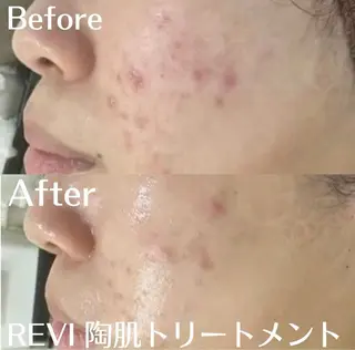 中目黒ハーブピーリン グ🌿ララピールのエステ・リラクイメージ