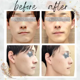 NARIS beautysalon 所属・Takahashi  Hiromiのエステ・リラクイメージ
