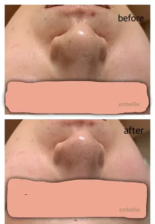 miyasaka erikoのネイルデザイン