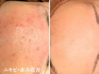 憧れ韓流素肌に🪽 毛穴肌管理のエステ・リラクイメージ